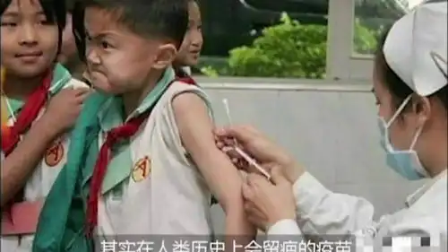 胳膊上的疤到底是啥卡介苗通过疤痕看年龄
