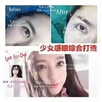 上海藤井原整形沪上首家真人案例上海眼鼻综合整形脂肪填充整形
