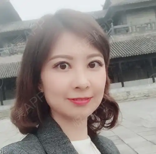 国庆出去游玩的我又回到了工作岗位上,眼睛45天了,比...鼻综合悦美整形
